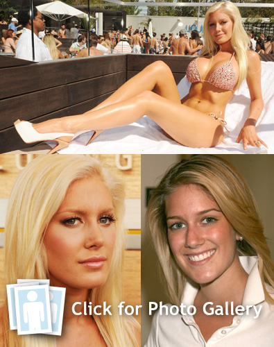 heidi montag surgery 2010. What the HELL has Heidi Montag